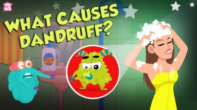 What Causes Dandruff? | How To Treat Dandruff?  | The Dr Binocs Show | Peekaboo Kidz