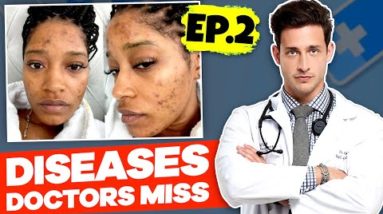 PCOS | Diseases Doctors Often Miss Ep. 2 #shorts