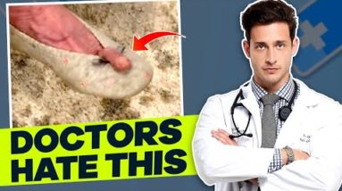 Foot Doctors Hate This | Hammer Toe #shorts