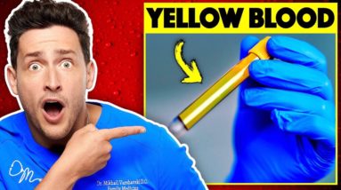 Here's Why Your Blood Is Mostly Yellow