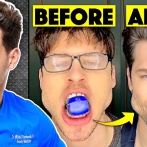 Do Jaw Trainers Actually Work? | Responding To Comments