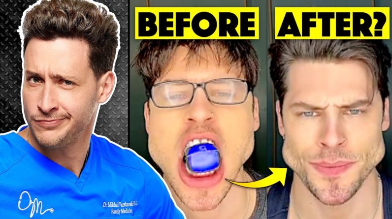 Do Jaw Trainers Actually Work? | Responding To Comments