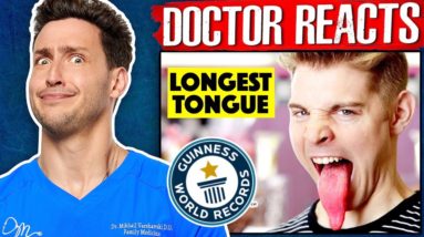 World Records Even Doctors Can't Believe