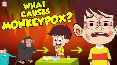 What Causes Monkeypox? | Monkeypox Outbreak 2022 | The Dr Binocs Show | Peekaboo Kidz