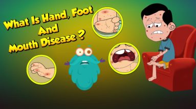 What Is Hand, Foot & Mouth Disease? | Infection In Children | The Dr Binocs Show | Peekaboo Kidz